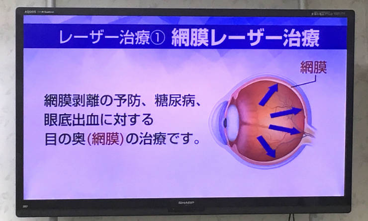兼松眼科の大型パネル3