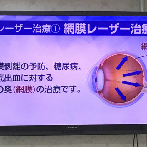 兼松眼科の大型パネル2